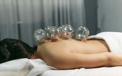 Hijama Treatment for Back Pain