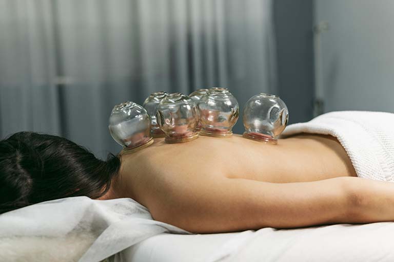 Hijama Treatment For Back Pain