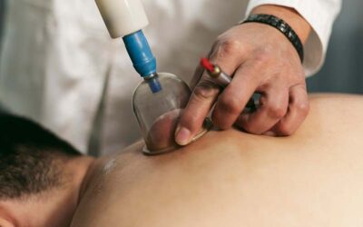 Hijama Treatment for Neck and Shoulder Pain