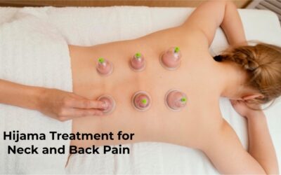 Hijama Treatment for Neck and Back Pain