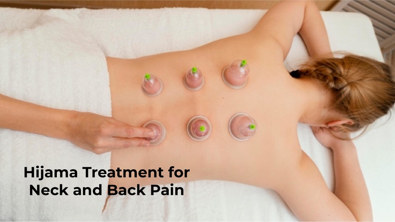Cupping Therapy for Neck and Back Pain Relief